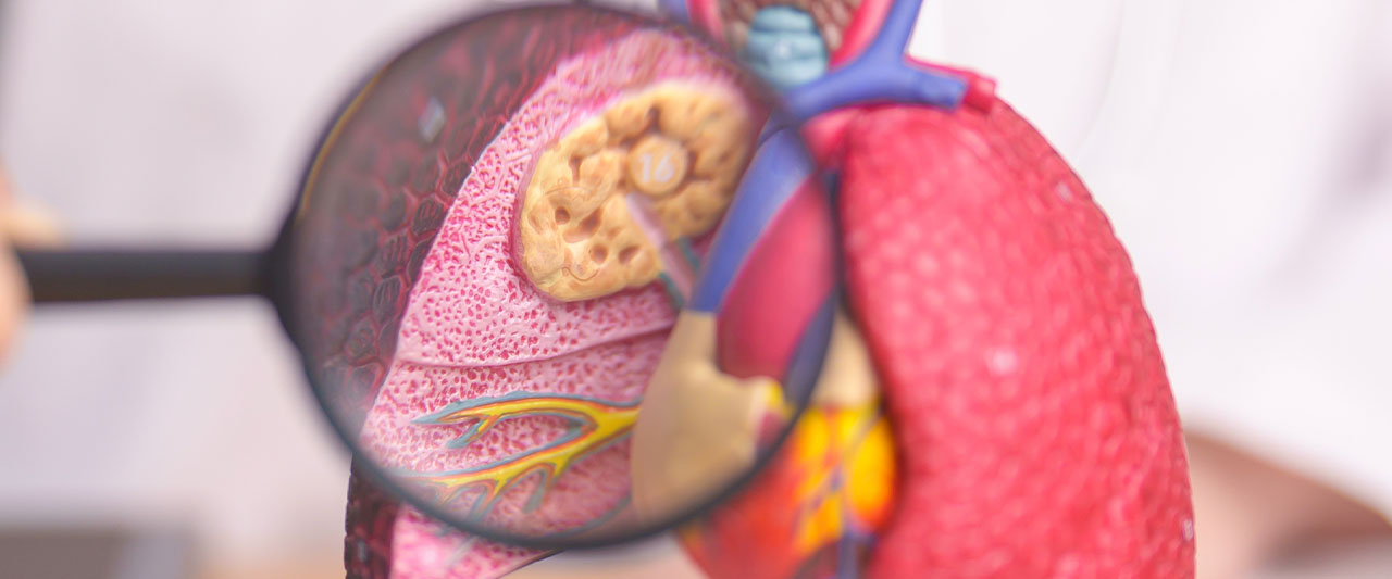 Cómo quitar la tos del sistema respiratorio